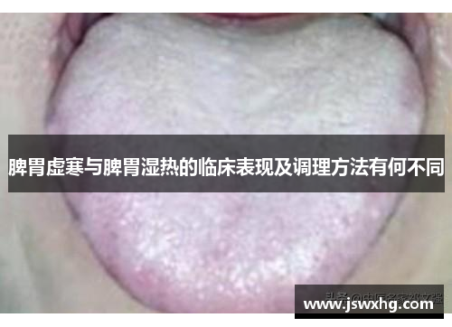 脾胃虚寒与脾胃湿热的临床表现及调理方法有何不同